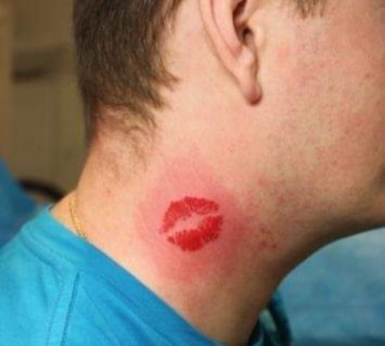 Red lips tattoo on neck